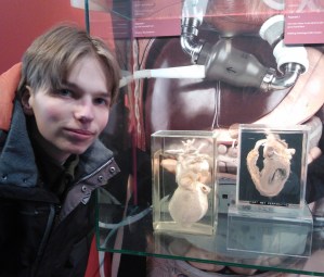 Altijd even kijken in de hal van het AZU: expositie met echte harten